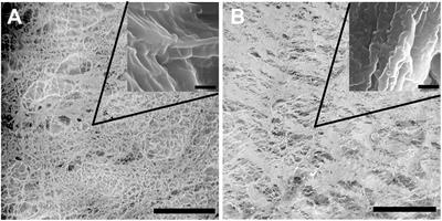 Multiparametric Optical Bioimaging Reveals the Fate of Epoxy Crosslinked Biomeshes in the Mouse <mark class="highlighted">Subcutaneous Implantation</mark> Model